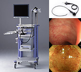 極細（経鼻的）内視鏡＆ハイビジョン内視鏡システム